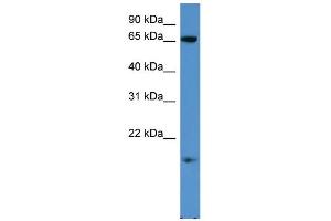 WB Suggested Anti-RHOXF1 Antibody Titration: 0. (RHOXF1 抗体  (C-Term))