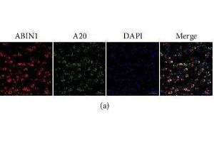 ABIN1 is colocated with A20 and NeuN and Iba-1, respectively, in the peri-infarct cortex. (TNIP1 抗体)
