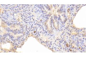 Detection of RAGE in Human Lung Tissue using Polyclonal Antibody to Receptor For Advanced Glycation Endproducts (RAGE) (RAGE 抗体  (AA 91-274))