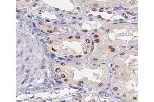 ABIN6267387 at 1/200 staining human kidney tissue sections by IHC-P. (ATF2 抗体  (pSer44, pSer62))