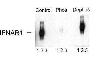 Image no. 1 for anti-Interferon alpha/beta Receptor 1 (IFNAR1) (pSer535), (pSer539) antibody (ABIN372660) (IFNAR1 抗体  (pSer535, pSer539))