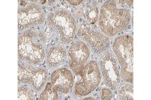 ABIN6266517 at 1/200 staining human kidney tissue sections by IHC-P. (Connexin 43/GJA1 抗体  (Internal Region))