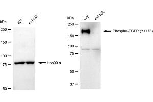 Western blotting analysis using Phospho-EGFR (Y) antibody (ABIN7798469). (Recombinant EGFR 抗体  (pTyr1173))