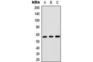 Western blot analysis of p57 Kip2 expression in HeLa (A), SHSY5Y (B), rat brain (C) whole cell lysates. (CDKN1C 抗体  (N-Term))
