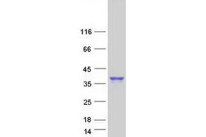 Western Blotting (WB) image for SLAM Family Member 8 (SLAMF8) protein (Myc-DYKDDDDK Tag) (ABIN2732141)