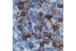 Immunohistochemical analysis of DOK2 staining in human lymph node formalin fixed paraffin embedded tissue section. (DOK2 抗体)