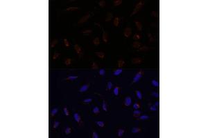 Immunofluorescence analysis of U-2 OS cells using  antibody (ABIN6131164, ABIN6136413, ABIN6136415 and ABIN6217209) at dilution of 1:100. (ACAT1 抗体  (AA 1-145))