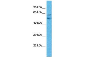 Host:  Rabbit  Target Name:  ZNF48  Sample Type:  Lung Tumor lysates  Antibody Dilution:  1. (ZNF48 抗体  (C-Term))