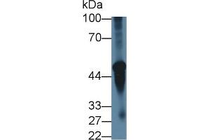 Detection of CHRNa3 in Mouse Cerebellum lysate using Polyclonal Antibody to Cholinergic Receptor, Nicotinic, Alpha 3 (CHRNa3) (CHRNA3 抗体  (AA 32-240))