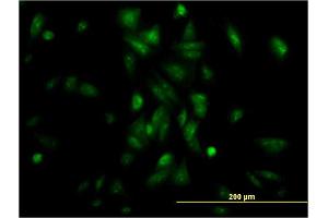Immunofluorescence of monoclonal antibody to NR1H4 on HepG2 cell. (NR1H4 抗体  (AA 363-472))