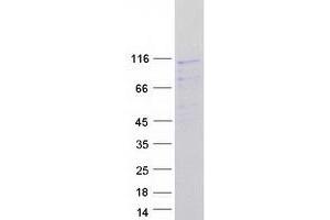 Western Blotting (WB) image for Peroxisomal Biogenesis Factor 6 (PEX6) protein (Myc-DYKDDDDK Tag) (ABIN2728698)