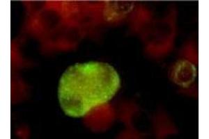 Immunofluorescence (IF) image for anti-Herpes Simplex Virus Type 2, Glycoprotein G (HSV2 gG) antibody (ABIN265564) (HSV-2 gG 抗体)