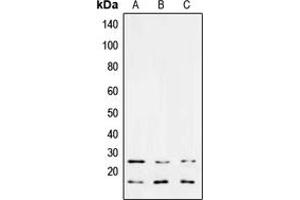 Western blot analysis of TGF beta 3 expression in MCF7 (A), NIH3T3 (B), PC12 (C) whole cell lysates.