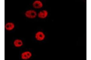ABIN6275332 staining HepG2 by IF/ICC. (OGFR 抗体  (Internal Region))