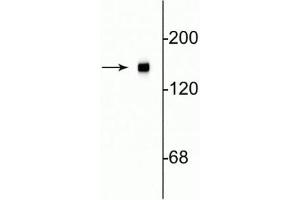 Western blot of rat cortical lysate showing specific immunolabeling of the ~145 kDa NF-M protein. (NEFM 抗体  (C-Term))