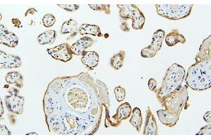 IHC analysis of MID1 using anti-MID1 antibody (ABIN6719400).