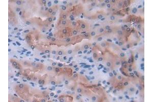 Immunohistochemistry (IHC) image for anti-Interleukin 12 alpha (IL12A) (AA 23-215) antibody (ABIN7430657)