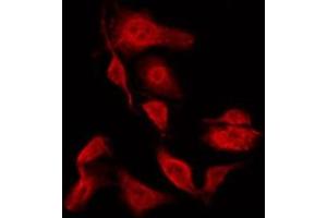 Immunofluorescence (fixed cells) (IF/ICC) image for anti-Heat Shock 27kDa Protein 1 (HSPB1) (pSer15) antibody (ABIN6256149)