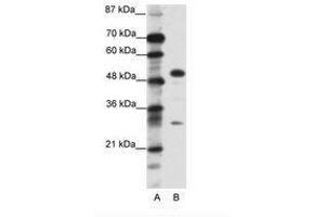 Image no. 1 for anti-Glial Cells Missing Homolog 1 (GCM1) (C-Term) antibody (ABIN6736096) (GCM1 抗体  (C-Term))