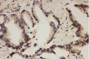 Immunohistochemistry (IHC) image for anti-Cullin 1 (CUL1) (AA 34-52), (N-Term) antibody (ABIN3042671)