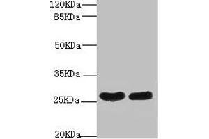 Western blot All lanes: CRP antibody at 2 μg/mL Lane 1: High values of serum at 1: 5 Lane 2: High values of serum at 1: 10 Secondary Goat polyclonal to rabbit IgG at 1/10000 dilution Predicted band size: 26, 11 kDa Observed band size: 26 kDa (CRP 抗体  (AA 19-224))