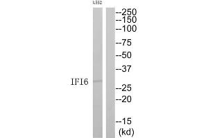 Western Blotting (WB) image for anti-Interferon, alpha-Inducible Protein 6 (IFI6) (C-Term) antibody (ABIN1852572)