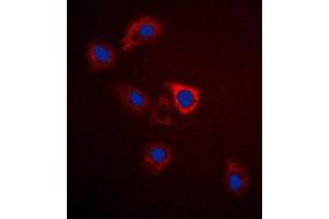 Immunofluorescent analysis of GPR75 staining in A549 cells. (GPR75 抗体  (C-Term))