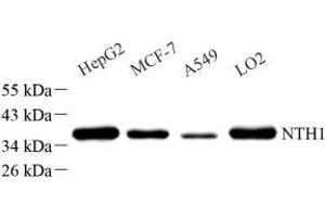 Western blot analysis of NTHL1 (ABIN7074866) at dilution of 1: 1000 (Nth Endonuclease III-Like 1 (NTHL1) 抗体)