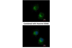 ICC/IF Image Immunofluorescence analysis of methanol-fixed HeLa, using IFIT3, antibody at 1:500 dilution. (IFIT3 抗体)