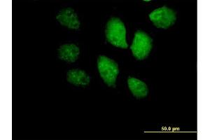 Immunofluorescence of purified MaxPab antibody to BRF1 on HeLa cell. (BRF1 抗体  (AA 1-473))