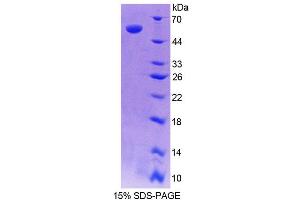 SDS-PAGE analysis of Human RARRES1 Protein.