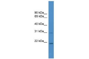 WB Suggested Anti-HOXB1 Antibody Titration:  0.