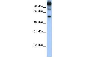WB Suggested Anti-FEZF1 Antibody Titration:  1 ug/ml  Positive Control:  Hela cell lysate (FEZF1 抗体  (C-Term))
