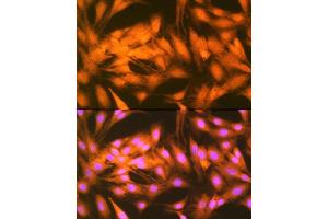 Immunofluorescence analysis of C6 cells using FGF1 Rabbit mAb (ABIN7267182) at dilution of 1:100 (40x lens). (FGF1 抗体)