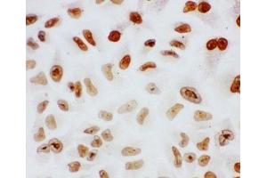 ICC testing of Splicing factor 1 antibody and HeLa cells (Splicing Factor 1 抗体  (N-Term))