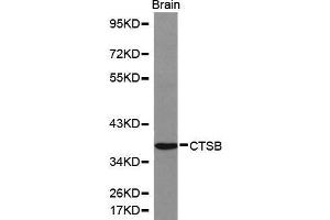 Western Blotting (WB) image for anti-Cathepsin B (CTSB) (AA 1-339) antibody (ABIN6214050) (Cathepsin B 抗体  (AA 1-339))