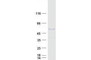Western Blotting (WB) image for Melanoma Antigen Family B, 4 (MAGEB4) protein (Myc-DYKDDDDK Tag) (ABIN2725214)
