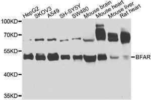Western blot analysis of extracts of various cell lines, using BFAR antibody. (BFAR 抗体  (AA 1-140))