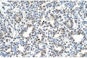 Immunohistochemical staining (Formalin-fixed paraffin-embedded sections) of human lung with MCM3 polyclonal antibody . (MCM3 抗体  (AA 726-775))