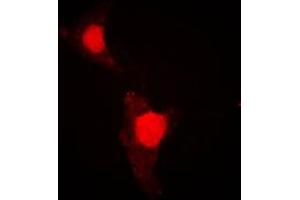 Immunofluorescent analysis of FOXO1 (pS319) staining in HeLa cells. (FOXO1 抗体  (pSer319))