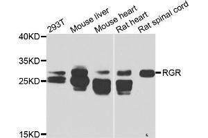 Western blot analysis of extracts of various cell lines, using RGR antibody (ABIN5975227) at 1/1000 dilution. (RGR 抗体)