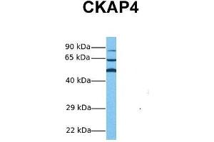 Host:  Rabbit  Target Name:  CKAP4  Sample Tissue:  Human Hela  Antibody Dilution:  1. (CKAP4 抗体  (Middle Region))