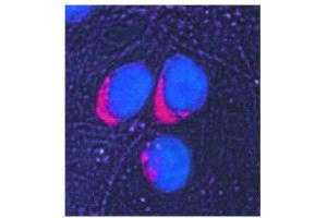 Image no. 3 for anti-Glucose-6-Phosphate Isomerase (GPI) antibody (ABIN347737) (GPI 抗体)