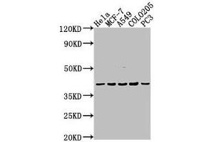Western Blot Positive WB detected in: Hela whole cell lysate, MCF-7 whole cell lysate, A549 whole cell lysate, COLO205 whole cell lysate, PC-3 whole cell lysate All lanes: LPAR2 antibody at 1:2000 Secondary Goat polyclonal to rabbit IgG at 1/50000 dilution Predicted band size: 40 kDa Observed band size: 40 kDa (EDG4 抗体  (AA 8-27))