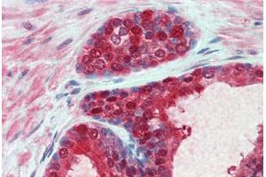 Human Prostate: Formalin-Fixed, Paraffin-Embedded (FFPE) (Cytidine Monophosphate (UMP-CMP) Kinase 1, Cytosolic (CMPK1) (AA 1-229) 抗体)
