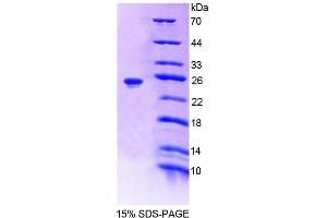 SDS-PAGE analysis of Rat AGXT Protein. (AGXT 蛋白)
