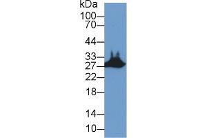 Detection of STC2 in Mouse Skeletal muscle lysate using Polyclonal Antibody to Stanniocalcin 2 (STC2) (Stanniocalcin 2 抗体  (AA 53-294))