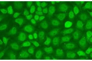 Immunofluorescence analysis of A-549 cells using CXXC1 Polyclonal Antibody (CXXC1 抗体)