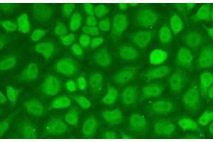 Immunofluorescence analysis of A-549 cells using CXXC1 Polyclonal Antibody (CXXC1 抗体)