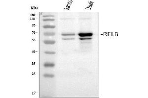 Western blot analysis of Rel B using anti-Rel B antibody (ABIN3042479).